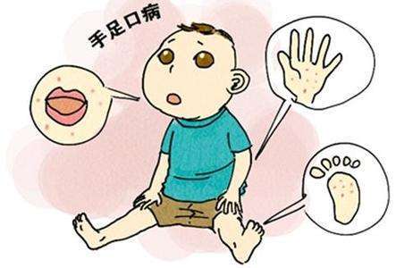 春意盎然，勿忘防治手足口